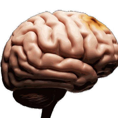 Brain decay animation